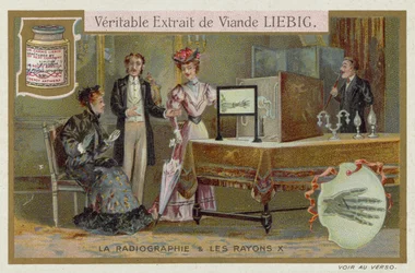 Radiographie und Röntgenstrahlen